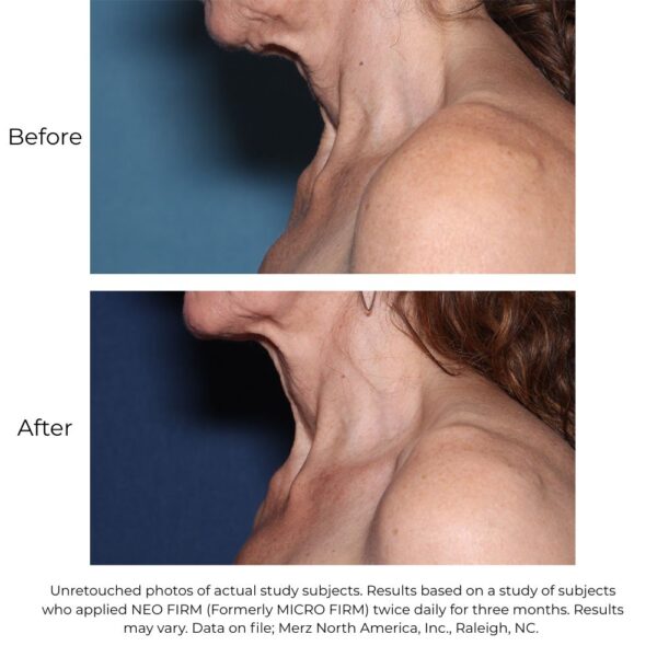Neocutis Neo Firm - Image 4