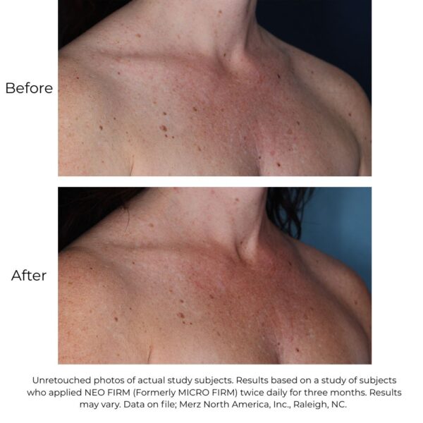 Neocutis Neo Firm - Image 3
