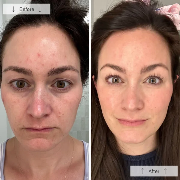 Omnilux Contour Face - Image 6