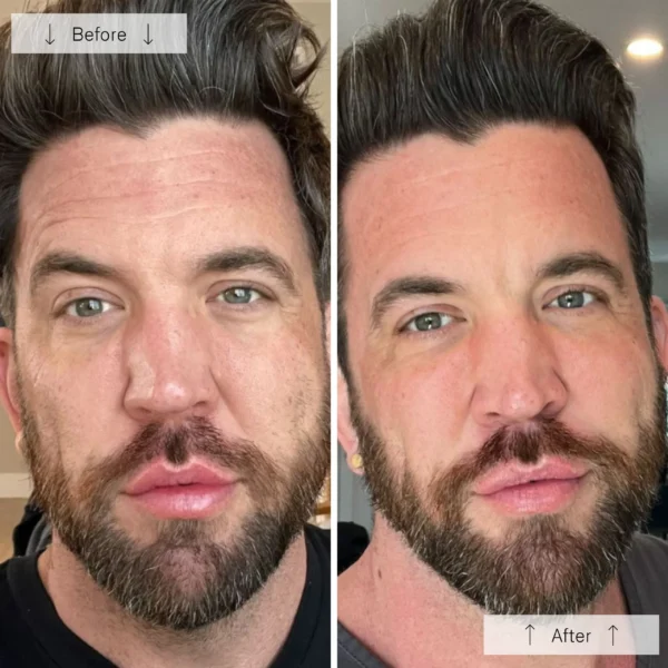 Omnilux Men - Image 6