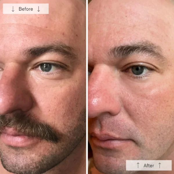 Omnilux Men - Image 7