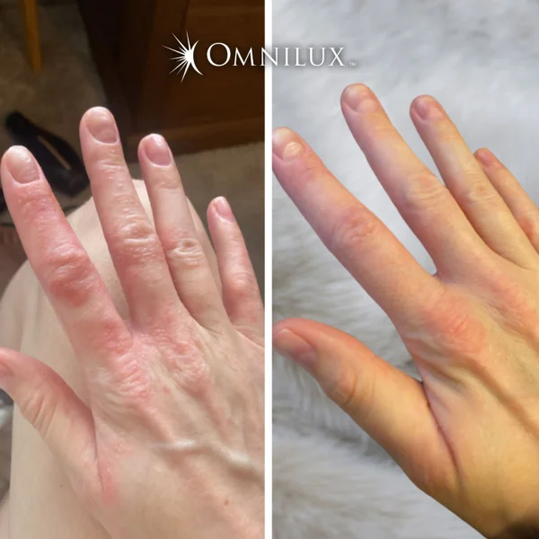 Omnilux Contour Glove - Image 8